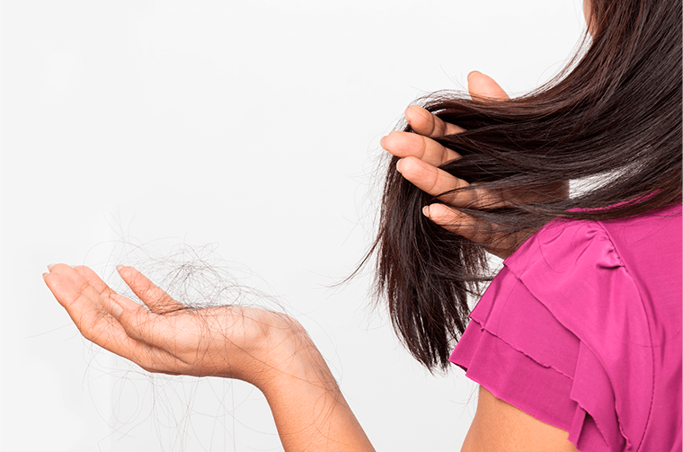 Alopecia androgenética (calvície): entenda como é no homem e na mulher